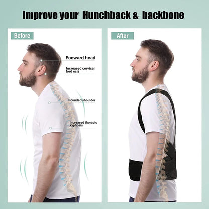 Smart Adjustable Full Body Posture Corrector For Men and Women